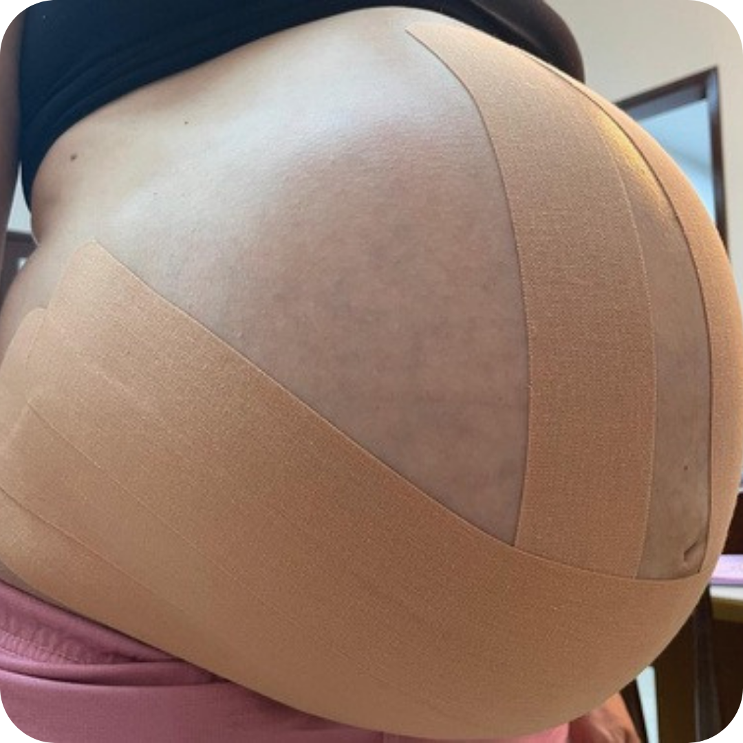 Atendimento de fisioterapia — gestação e pós-parto