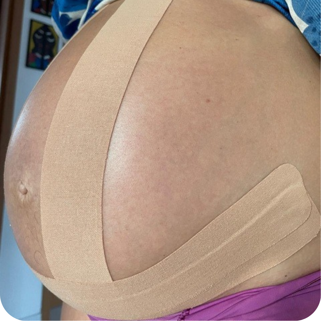 Fisioterapia gestacional — cuidado e recuperação